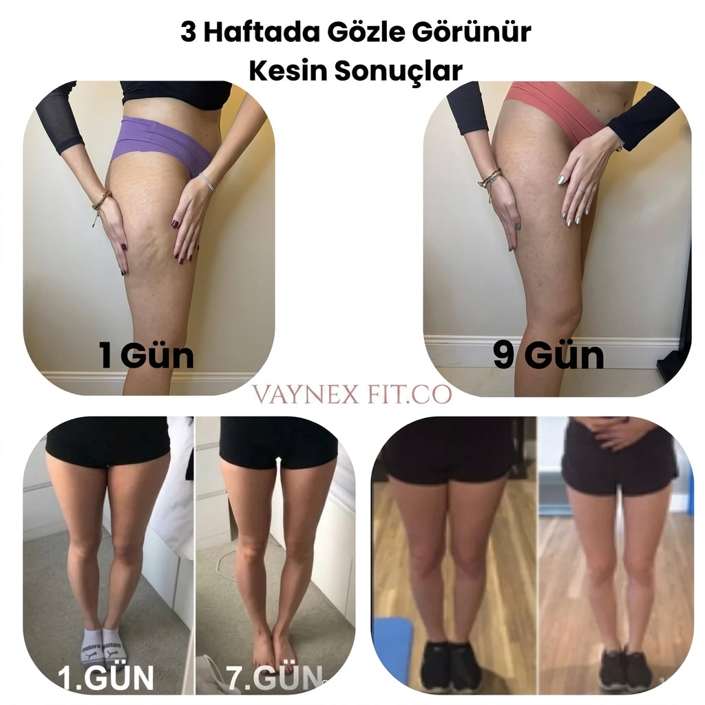 Vaynex Fit™ Bacak İncelten Sıkılaştıran Masaj Aleti